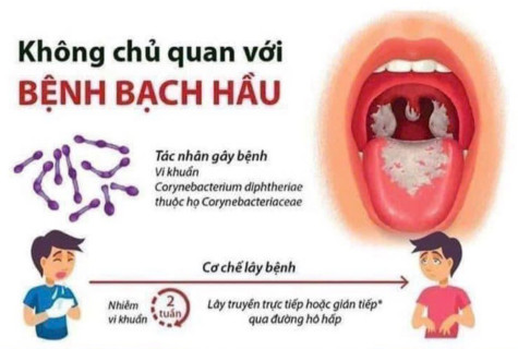 Những điều cần biết về bệnh bạch hầu và cách phòng tránh