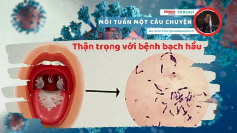 MỖI TUẦN MỘT CÂU CHUYỆN: Thận trọng với bệnh bạch hầu