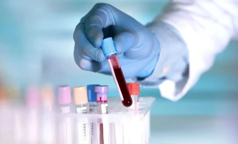 Xét nghiệm máu siêu nhạy của Johns Hopkins phát hiện ADN ung thư sớm 3 năm